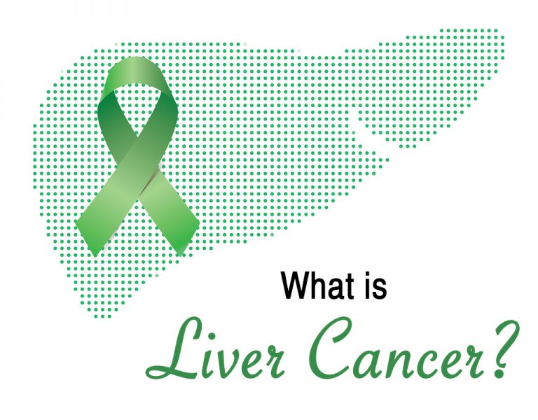 Liver Cancer