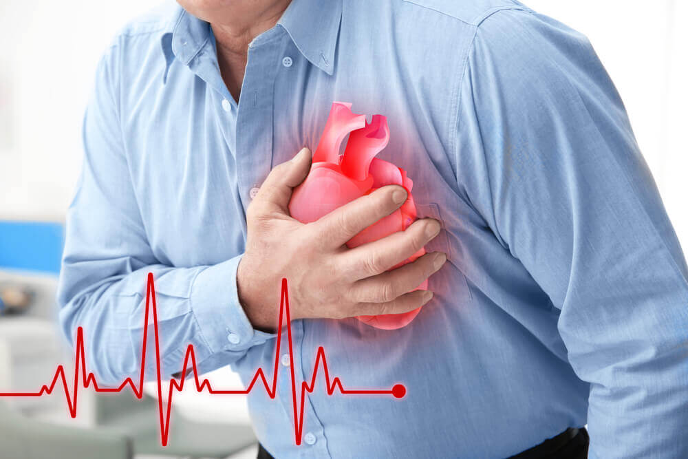 Mempunyai simptom serangan jantung walaupun nilai EKG dan darah normal