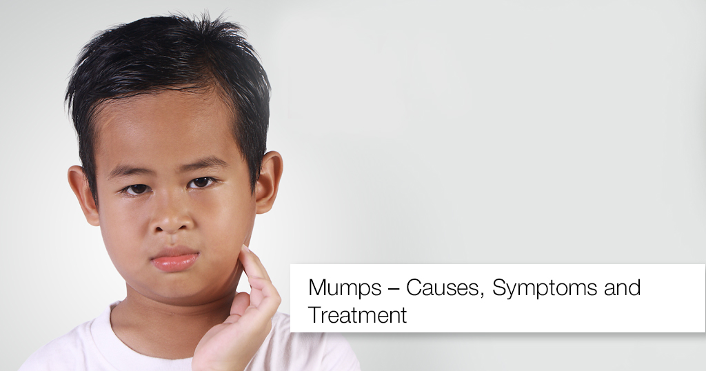 Mumps – Causes, Symptoms and Treatment