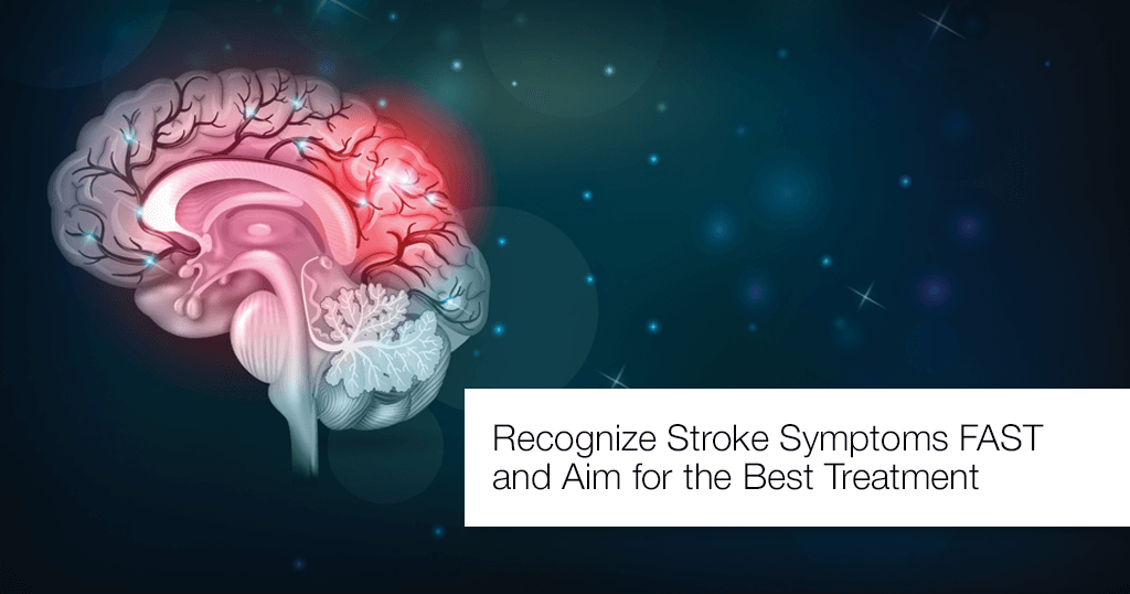 Recognize Stroke Symptoms FAST and Aim for the Best Treatment