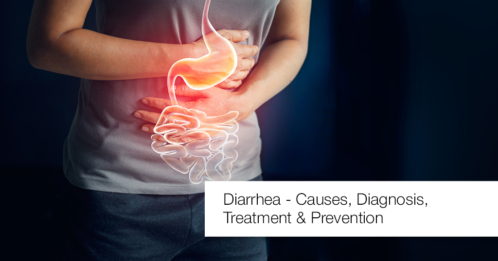 Diarrhea Causes, Diagnosis, Treatment and Prevention