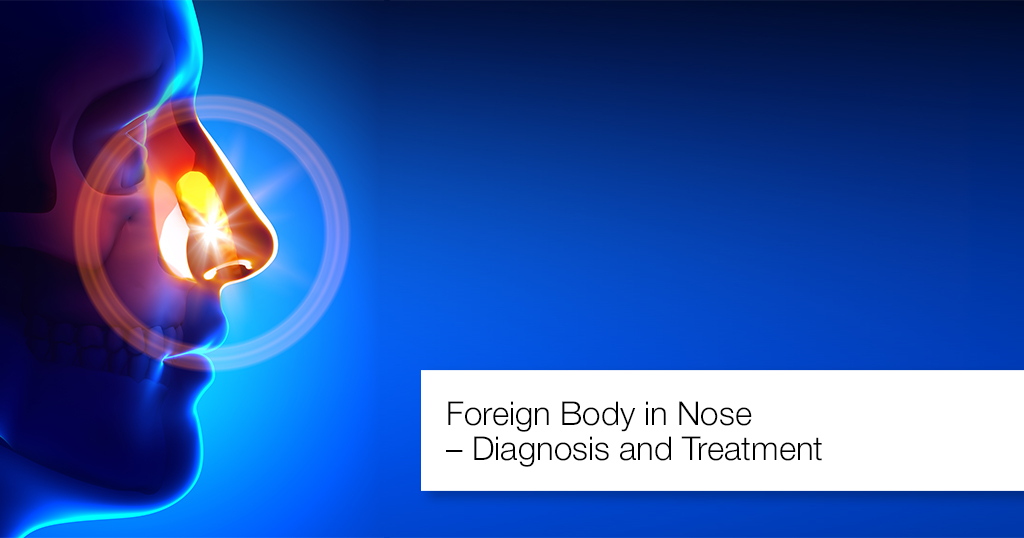 Foreign Body in Nose