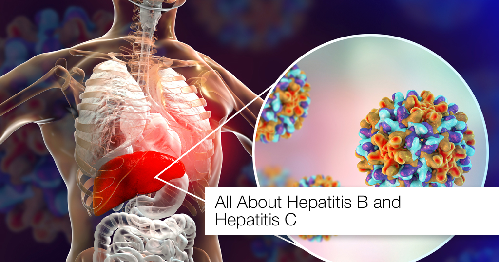 Hepatitis B And Hepatitis C