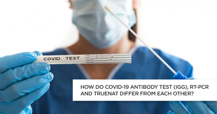 COVID 19 Antibody Test