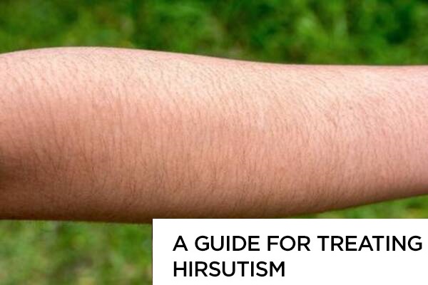 A Guide for Treating Hirsutism