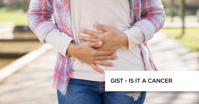 GIST Symptoms and Treatment