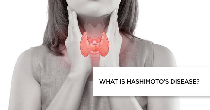 Hashimoto's Disease