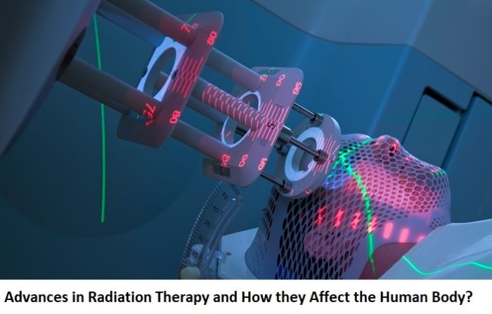 Advances in Radiation Therapy and How they Affect the Human Body