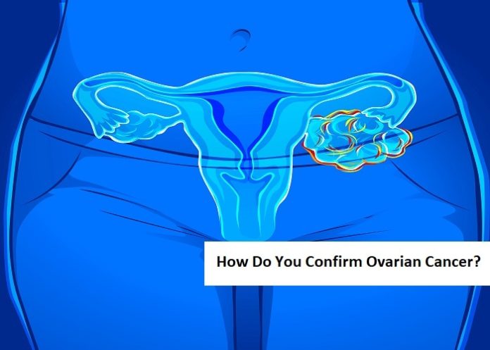How Do You Confirm Ovarian Cancer