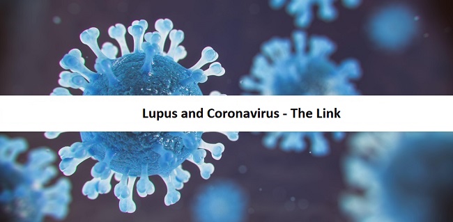Lupus and Coronavirus