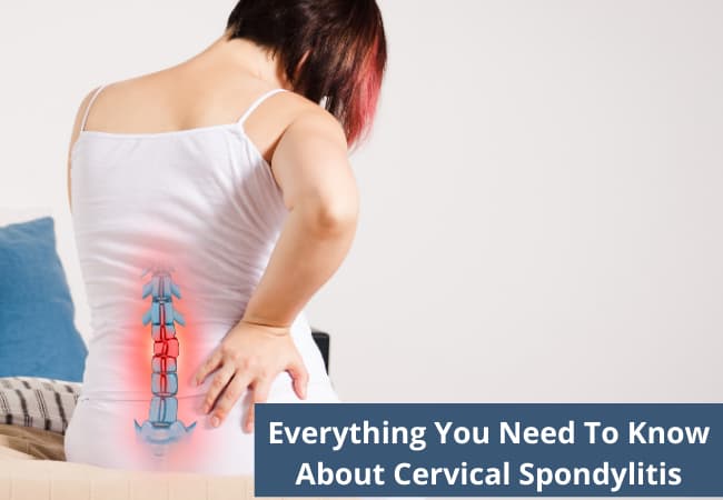 Everything You Need To Know About Cervical Spondylitis