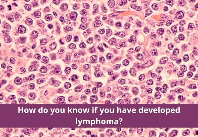 How do you know if you have developed lymphoma
