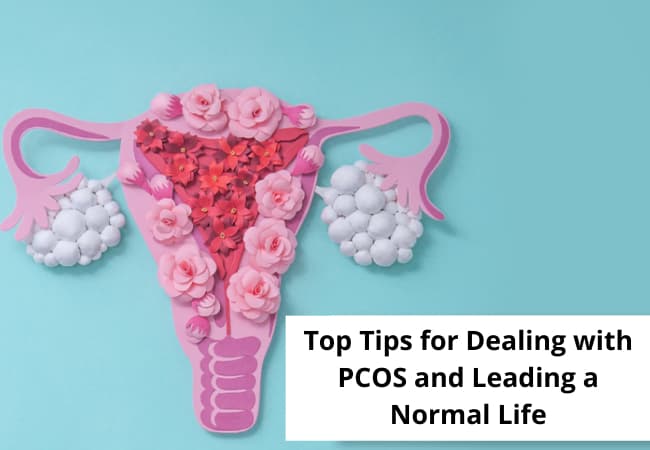 Top Tips for Dealing with PCOS and Leading a Normal Life