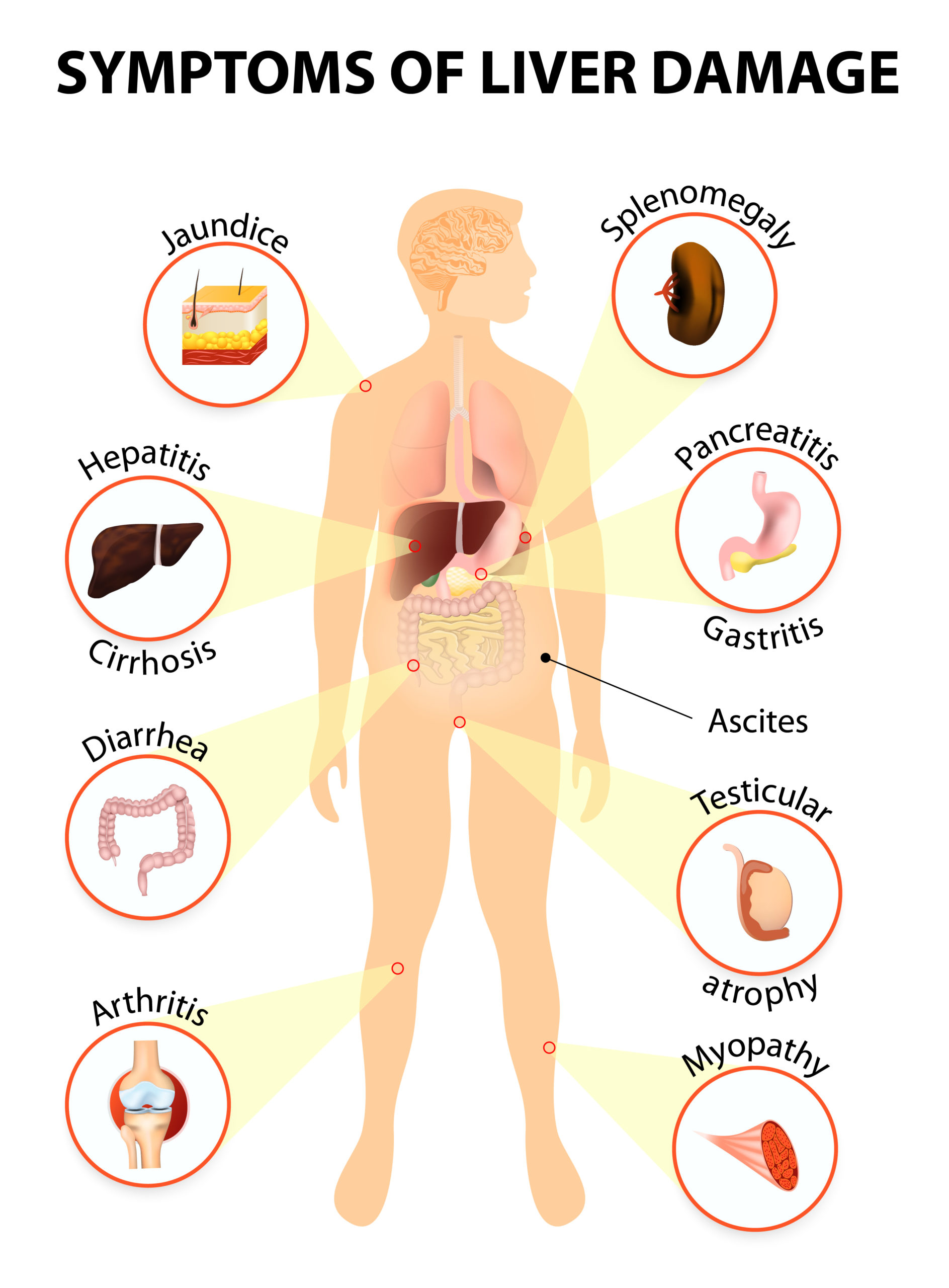 causes of liver pain symptoms