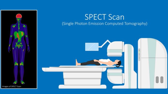 What is a SPECT Scan Commonly Used For