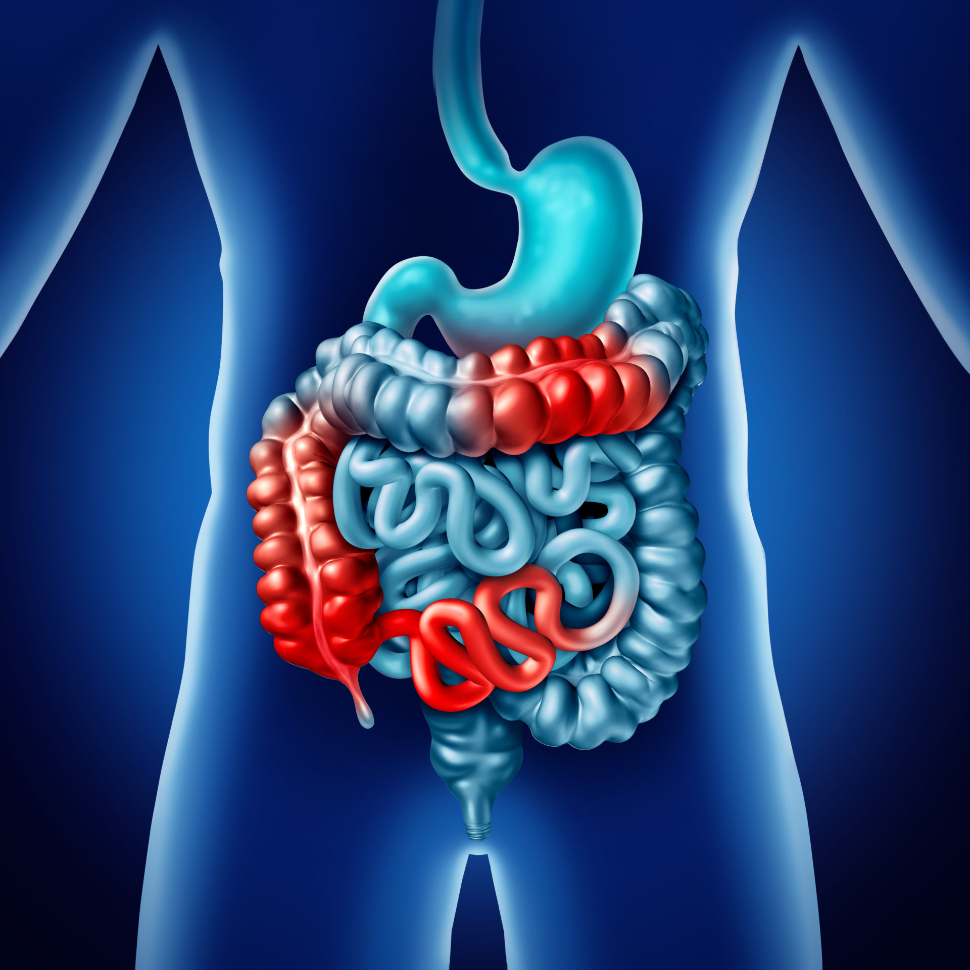 Intestinal Obstruction - Factors, Types and Treatment