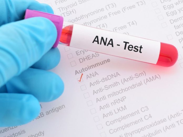 Antinuclear Antibody Test