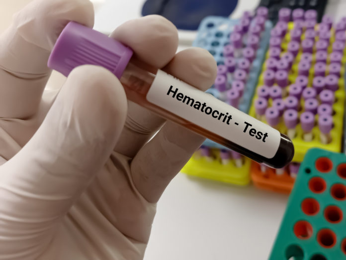 Hematocrit Test