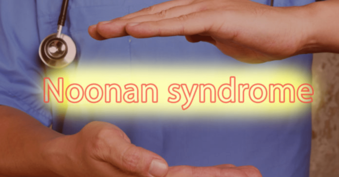 Noonan Syndrome