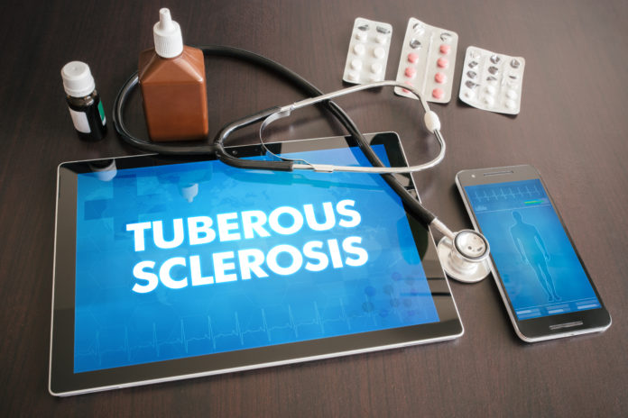 Tuberous sclerosis