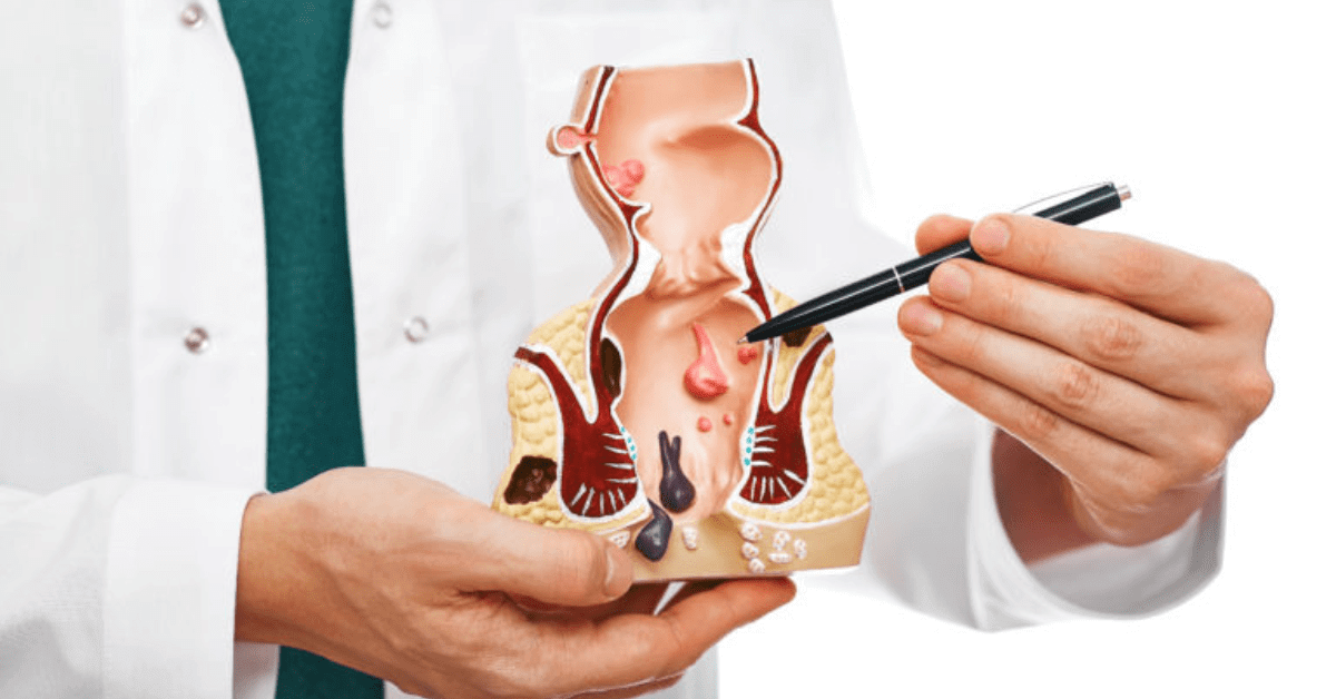 Anal Abscess - Causes, Symptoms and Treatment - Apollo Hospital Blog