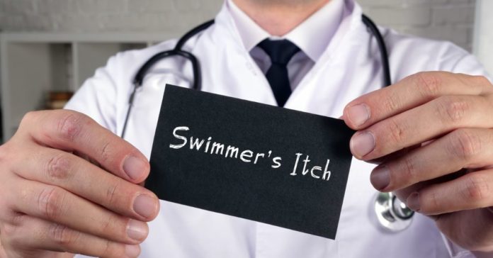 Swimmer’s Itch