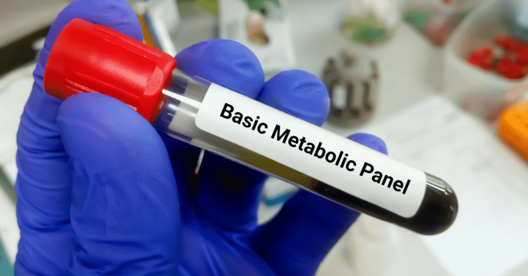 Basic Metabolic Panel (BMP) What It Is, Risk Factors & Results