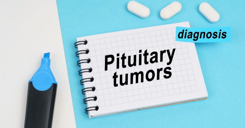 Pituitary Tumors Symptoms Causes And Treatment 