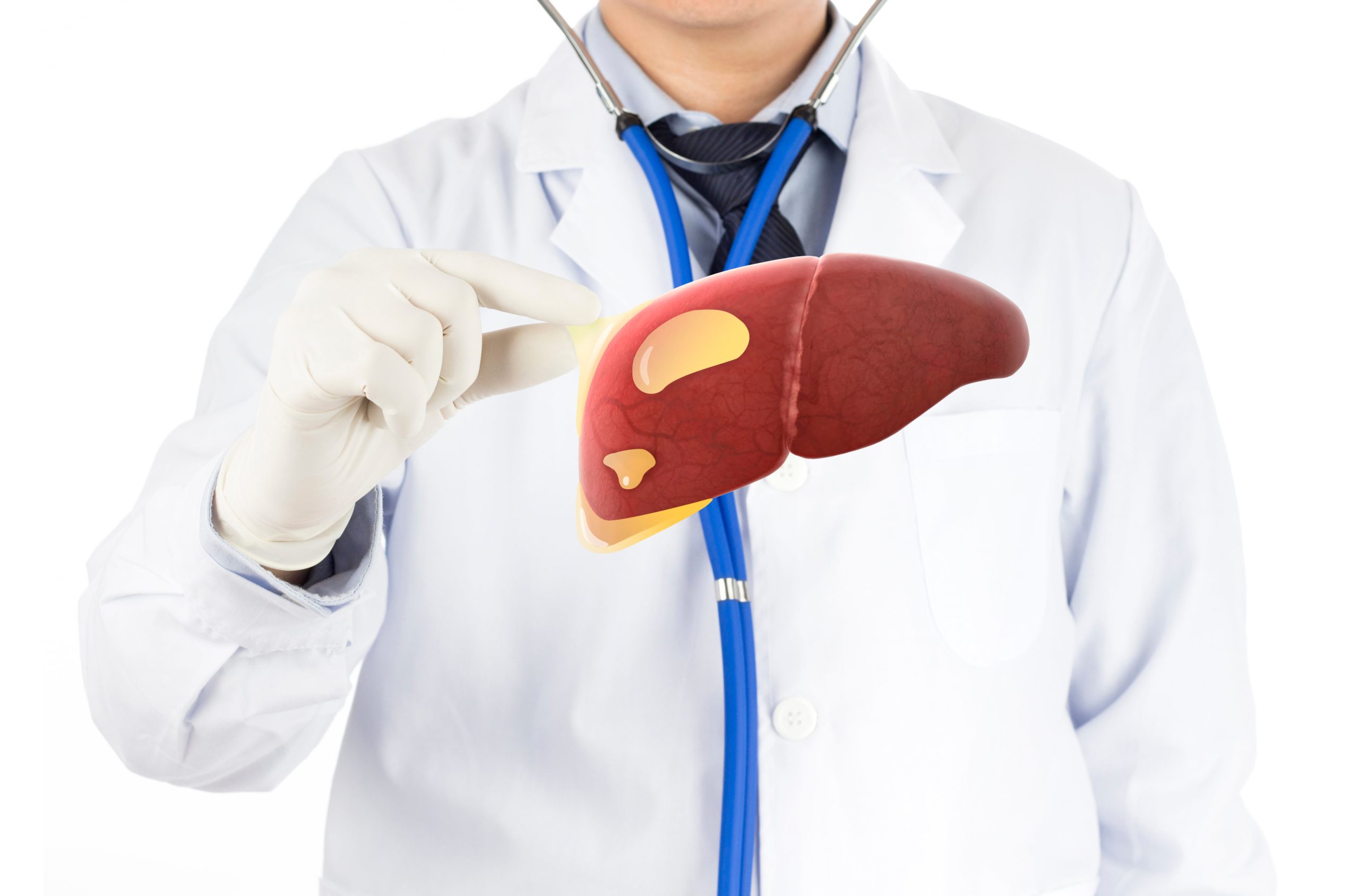 Liver Cysts Types Symptoms Causes Diagnosed And Treax`tment