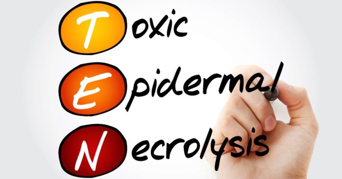 Toxic Epidermal Necrolysis (TEN)
