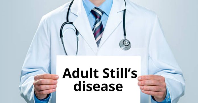 Adult Still's Disease: Causes, Symptoms, Treatment and Risk Factors