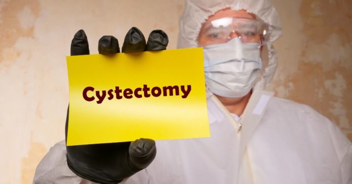 Bladder Removal Surgery (Cystectomy)