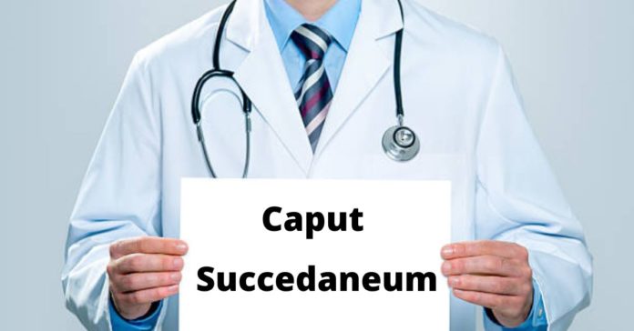 Caput Succedaneum: Causes, Symptoms an Treatment