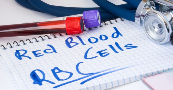 Red Blood Cell Count High (RBC): Causes, Symptoms and Treatment