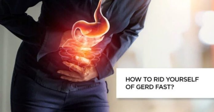 How to rid yourself of GERD fast?