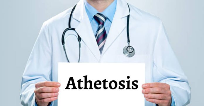 Athetosis: Symptoms, Causes, Diagnosis and Treatment