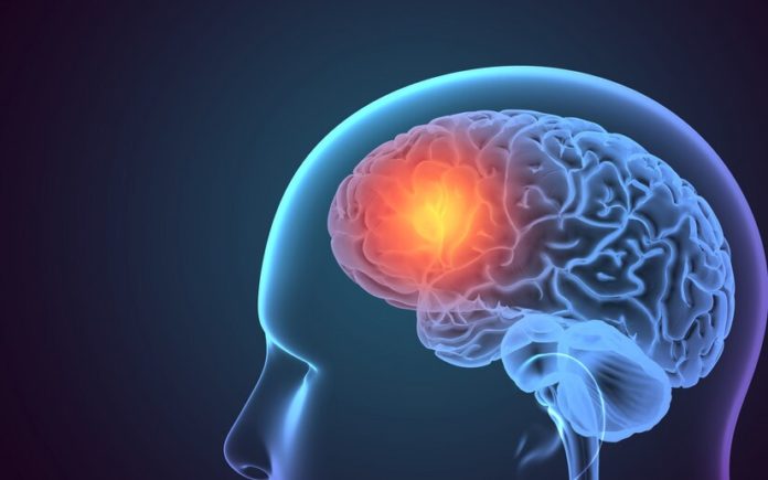 Hypothalamus : Symptoms, Causes and Ttreatment