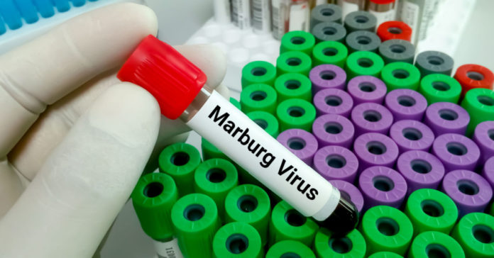 Marburg Virus Disease (MVD): Transmission, Symptoms, Prevention Treatment