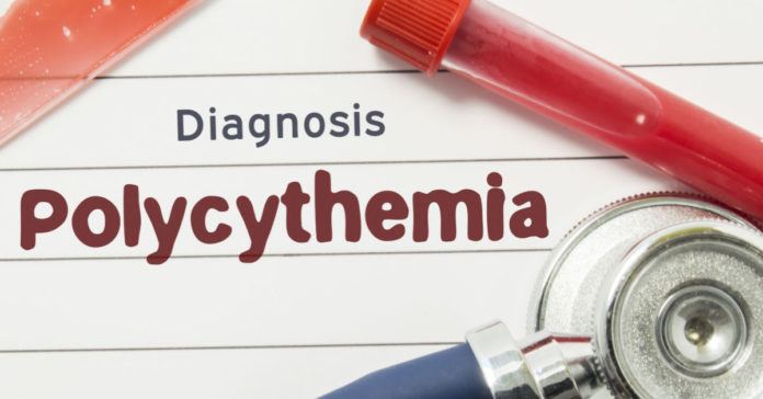 Polycythemia Vera: Causes, Symptoms Diagnoses and Treatments
